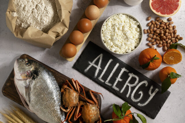 https://www.inomentors.cz/wp-content/uploads/2023/07/view-allergens-commonly-found-food-scaled-e1688248319312-640x427.jpg